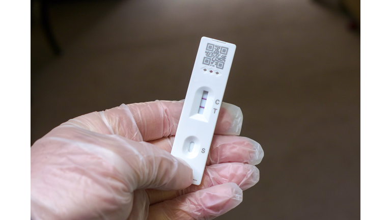 Positive Cassette rapid test for COVID-19, Test Result by Using Rapid Test Device for COVID-19 Novel Coronavirus.