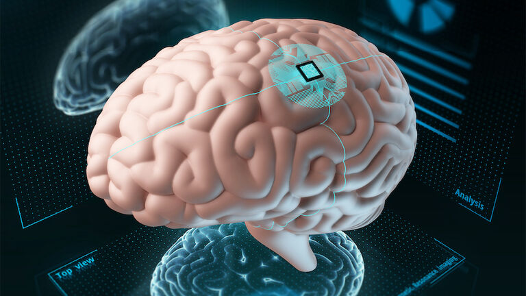 Chip implanted in human brain, illustration