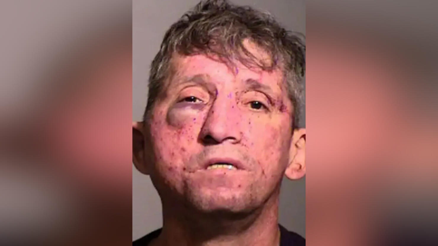 Homeowner Pummels Burglary Suspect Holds Him Until Police Arrive Iheart