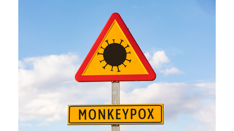 Red and yellow danger road sign with virus and and text: 'MONKEYPOX', with the sky in the background. Concept of road sign, pandemic, virus, epidemic, Nigeria, smallpox and monkey