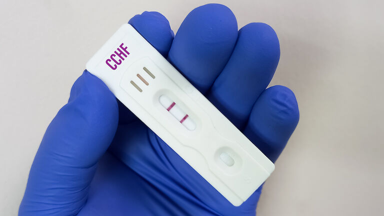 Rapid test device or cassette for Crimean-Congo hemorrhagic fever(CCHF) virus test, Nairovirus test, Tick borne virus, Nosebleed fever.