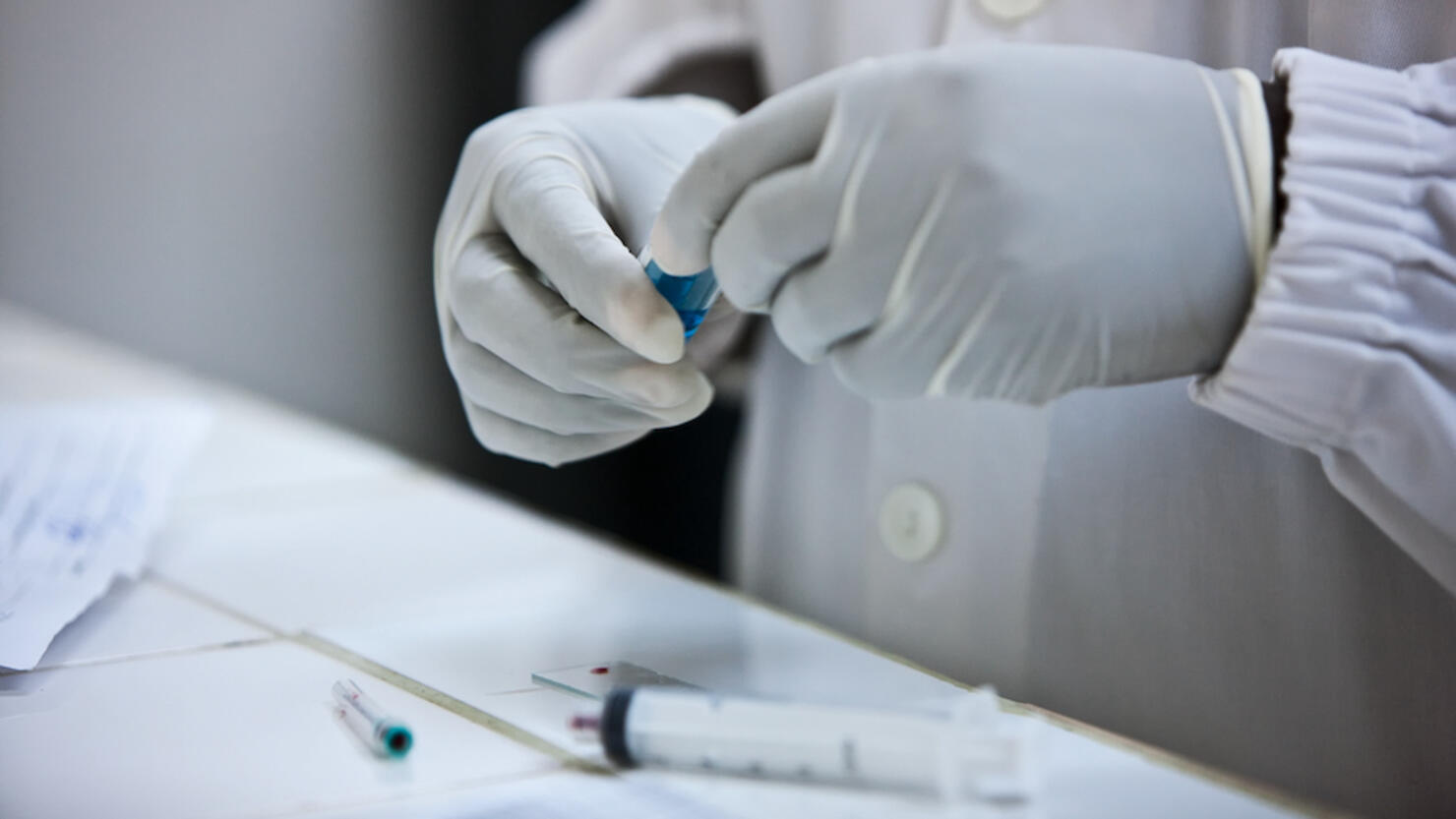 Hands of doctor holding blood test plates.