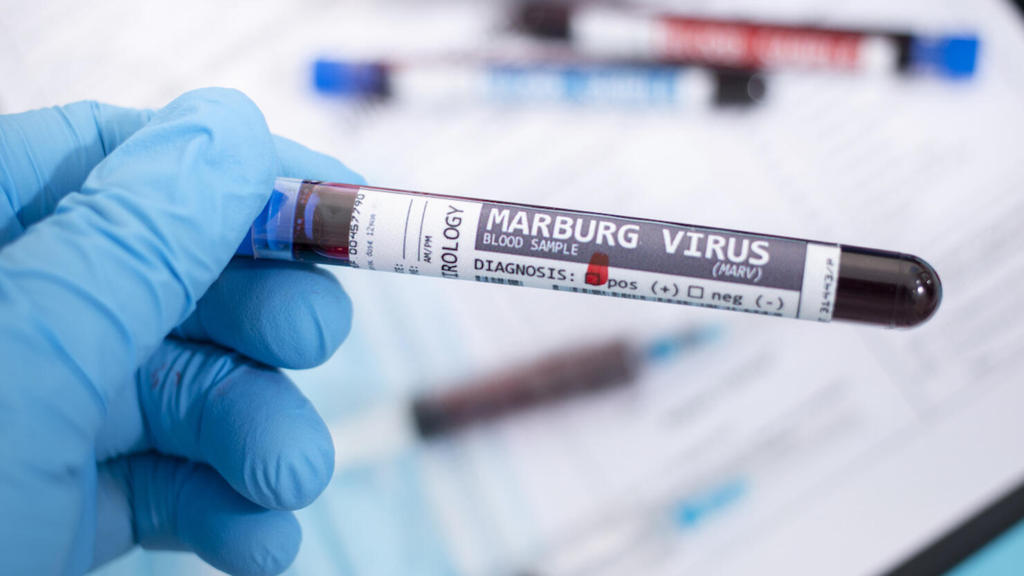 Blood samples with infected virus