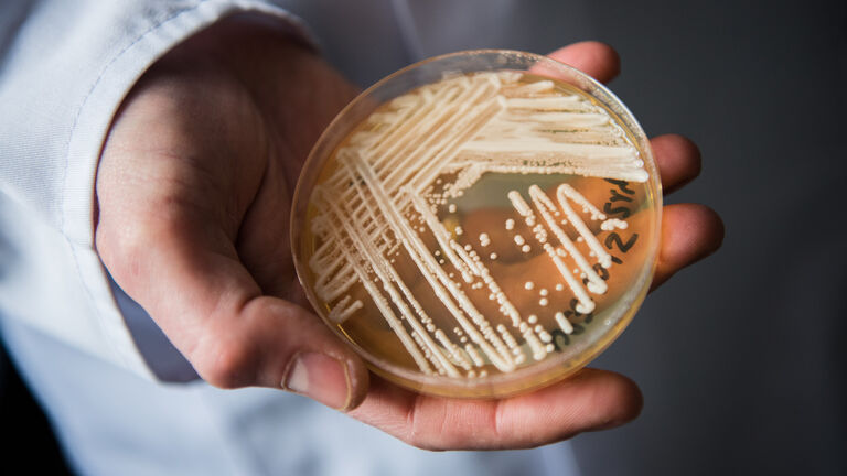 Experts warn of newly-discovered yeast