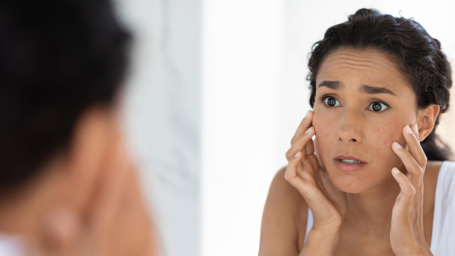 Atopic Skin Concept. Worried Young Woman Looking At Mirror And Touching Face