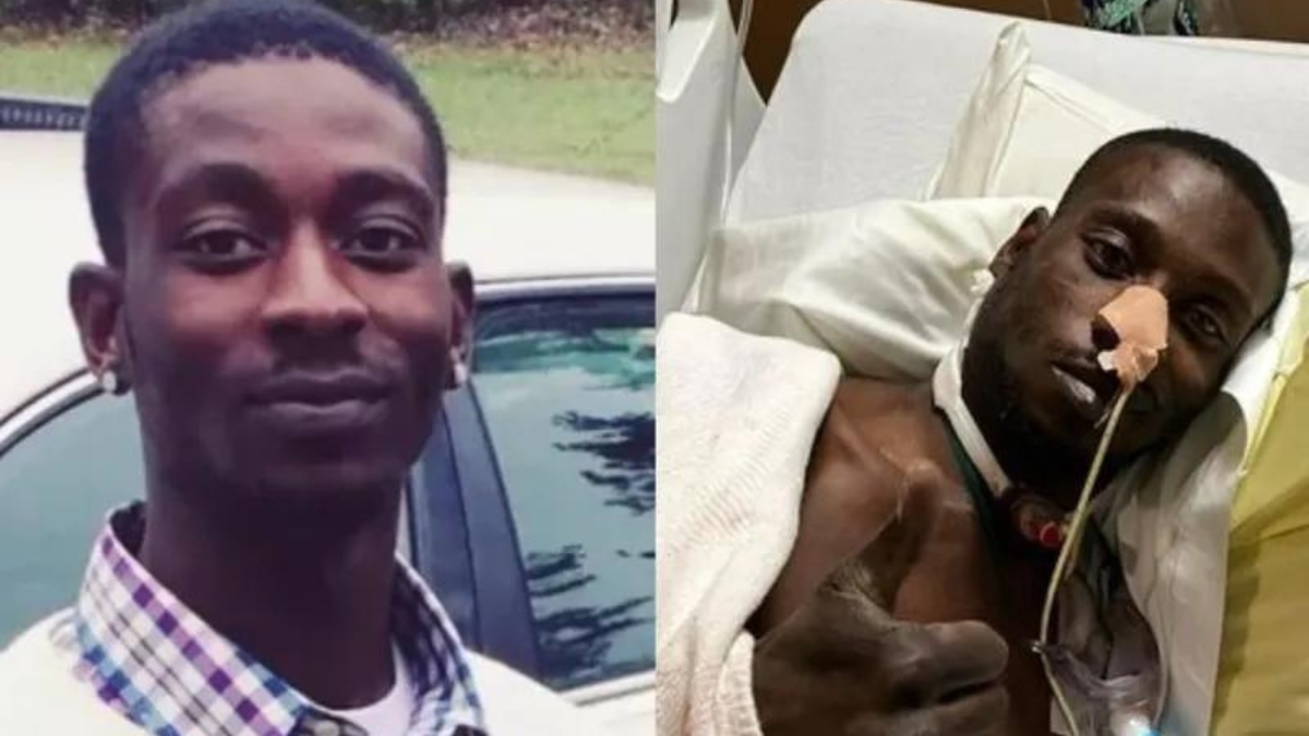 Black Man Shot In Mouth By White Deputy To File $400 Million Lawsuit ...