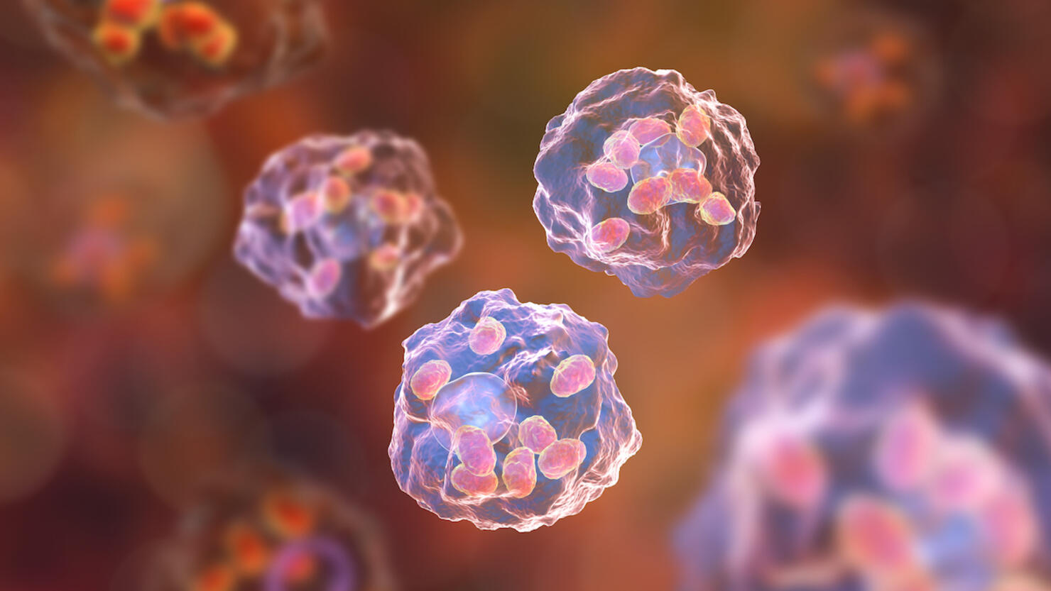 Macrophages infected by Leishmania amastigotes