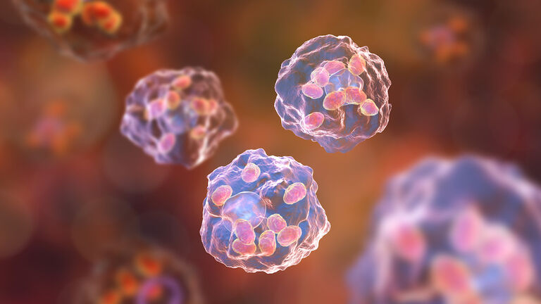 Macrophages infected by Leishmania amastigotes