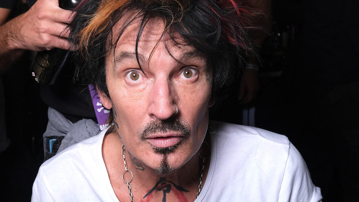 Tommy Lee Shares Gruesome Photos After Undergoing Hand Surgery | iHeart