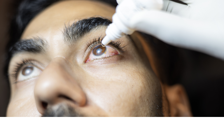 Ophthalmologist pouring eye drops in the eye of a patient with conjunctivitis or Eye Flue.