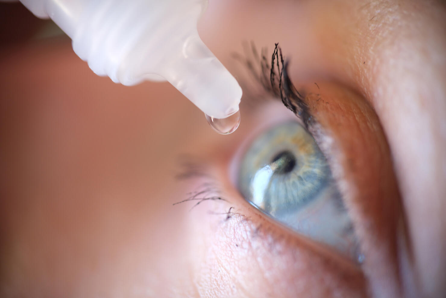 Drops from vial dripping into woman eye closeup