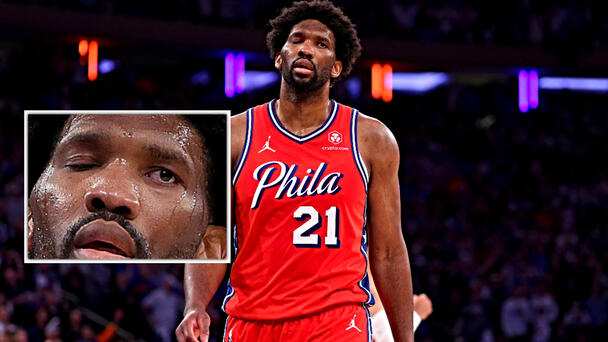 Sports Doctor Discusses His Concerns on Joel Embiid's Bizarre Eye Movements