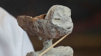 Peculiar Piece of Metal Found During Dissection of Hand From 'Alien Body' 