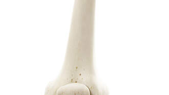 U.S. Agency Recommends Women 65 And Older Get Bone Density Scans