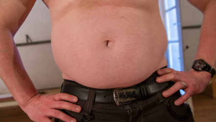 Man With Huge Hernia Arrested For Theft