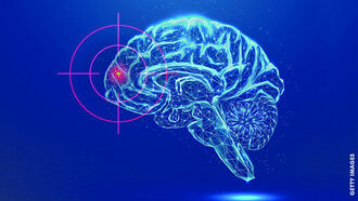 The Rise of 'Brain Weapons'