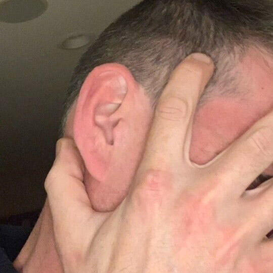 Ear Pain