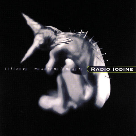 Radio Iodine