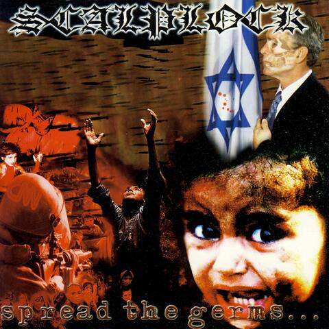 Scalplock