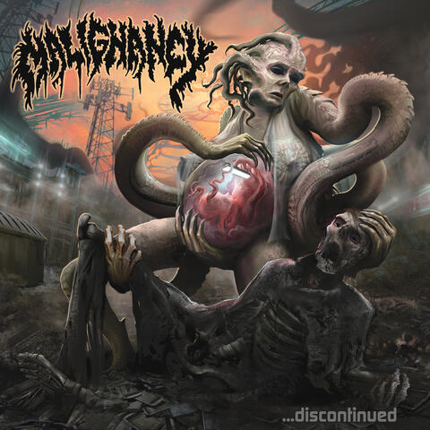 Malignancy