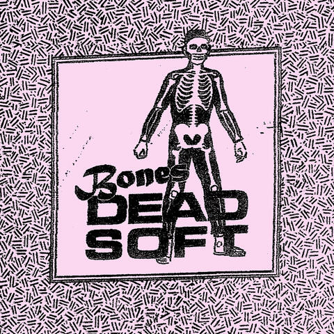 Bones
