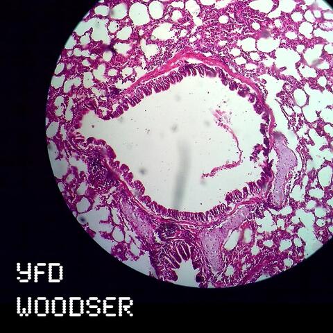 YFD