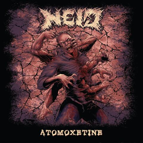 Atomoxetine