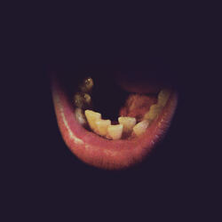 Acid