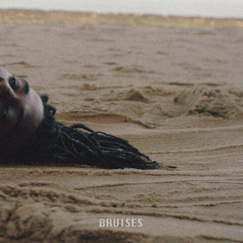 Bruises