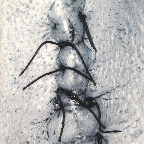 Infliction