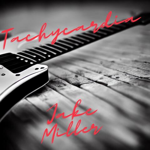 Tachycardia