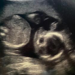 Coming Soon (feat. MKB)