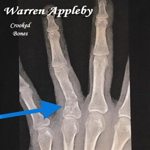 Crooked Bones