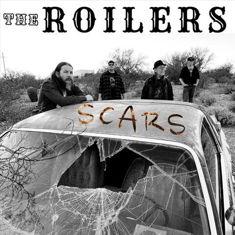 Scars