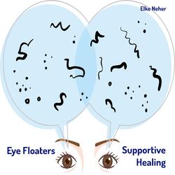Eye Floaters Supportive Healing