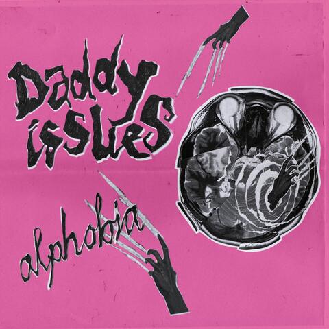Alphobia