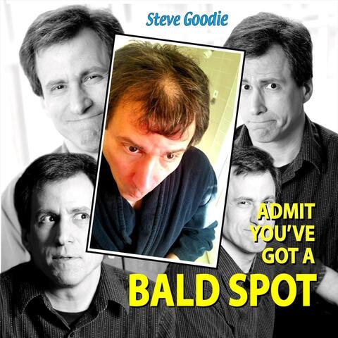 Admit You've Got a Bald Spot
