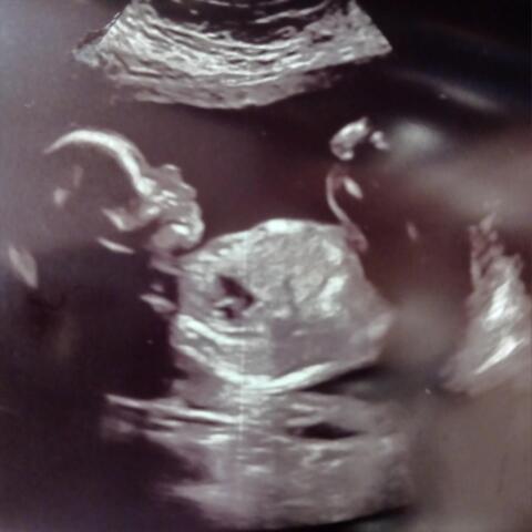 "Unconditional" (Pregnancy Anthem)