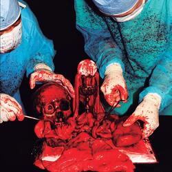 Apotheosis Emissions of Malodorous Procedures