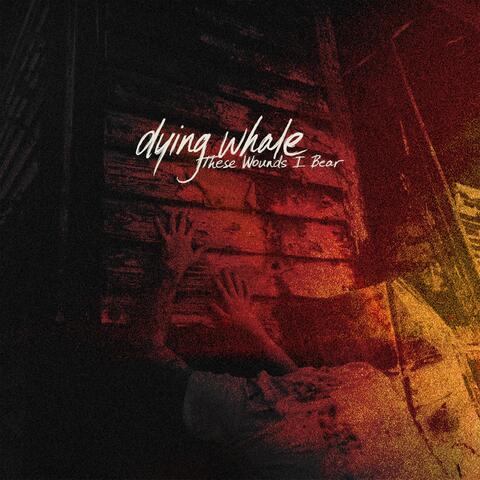 These Wounds I Bear