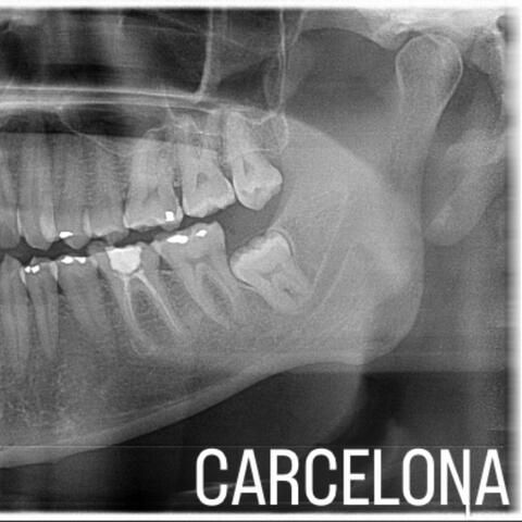 Carcelona