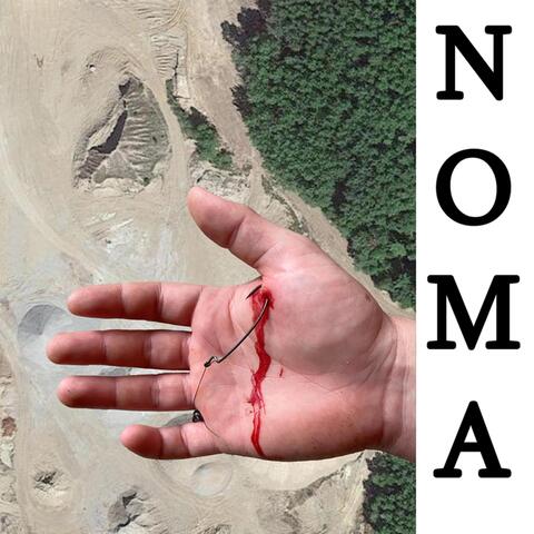 NOMA