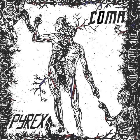 Coma
