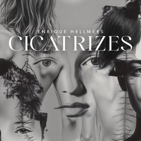 Cicatrizes