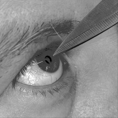 May Cause Irritation