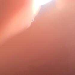 Lancing the Abscess