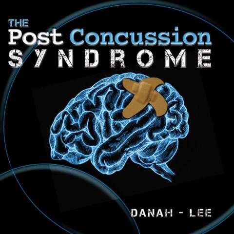 The Post Concussion Syndrome