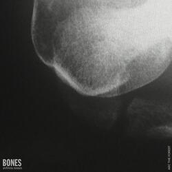 Bones (Avbvrn Remix)