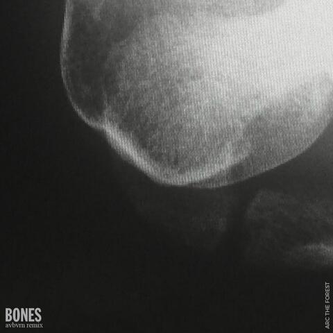 Bones (Avbvrn Remix)