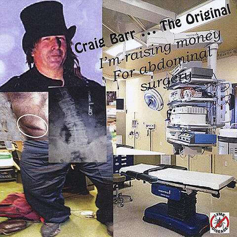 Craig Barr...the Original I'm Raising Money for Abdomial Surgery
